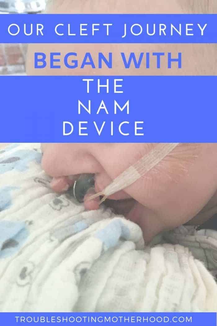 Our cleft journey began with the NAM device (Nasoalveolar molding)